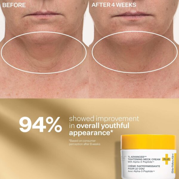 StriVectin Tighten & Lift Peptight Face Lift Serum with Tigh...