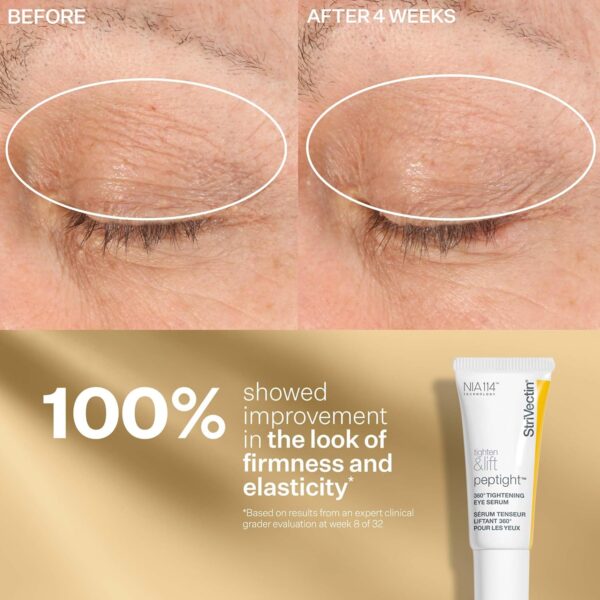 StriVectin Tighten & Lift Peptight Face Lift Serum with Tigh...