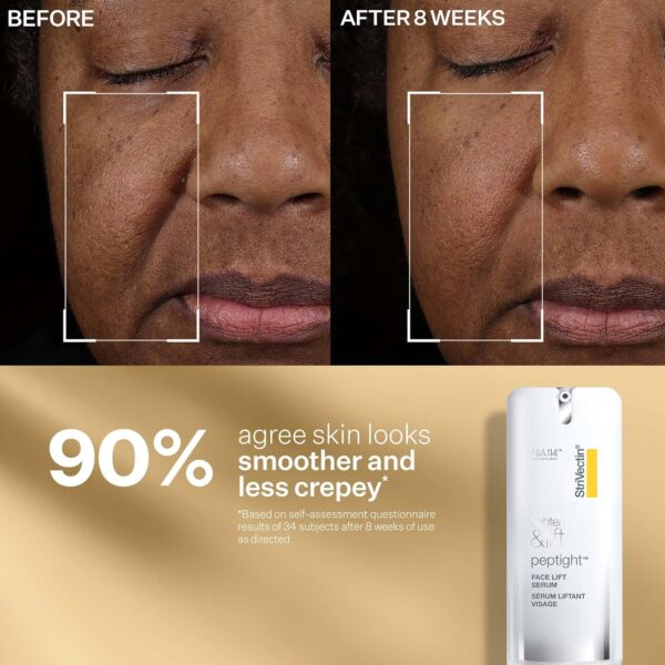 StriVectin Tighten & Lift Peptight Face Lift Serum with Tigh...